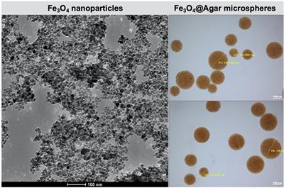 Magnetic Agarose Microspheres/Hyaluronic Acid Hydrogel as a Trackable Bulking Agent for Vesicoureteral Reflux Treatment